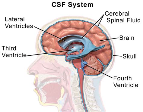Cerebrospinal Fluid (CSF) Leak .